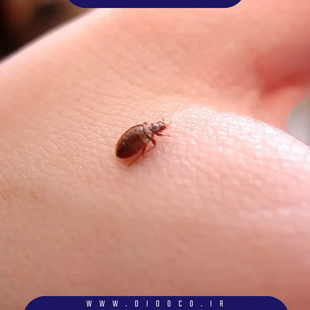 ساس که در فصل تابستان بیشتر شده و حشره ای آزار دهنده است